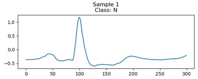 Understanding RNN (Recurrent Neural Networks)