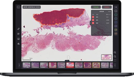 In-Depth Imaging: A Pathology Diagnosis System Based on TensorFlow