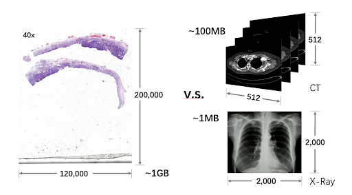 In-Depth Imaging: A Pathology Diagnosis System Based on TensorFlow