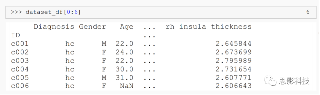 Step-by-Step Tutorial for Brain Imaging ML Models