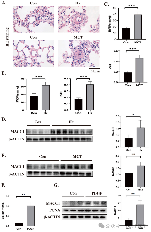 Key Gene Screening and Validation in Non-Tumor Bioinformatics