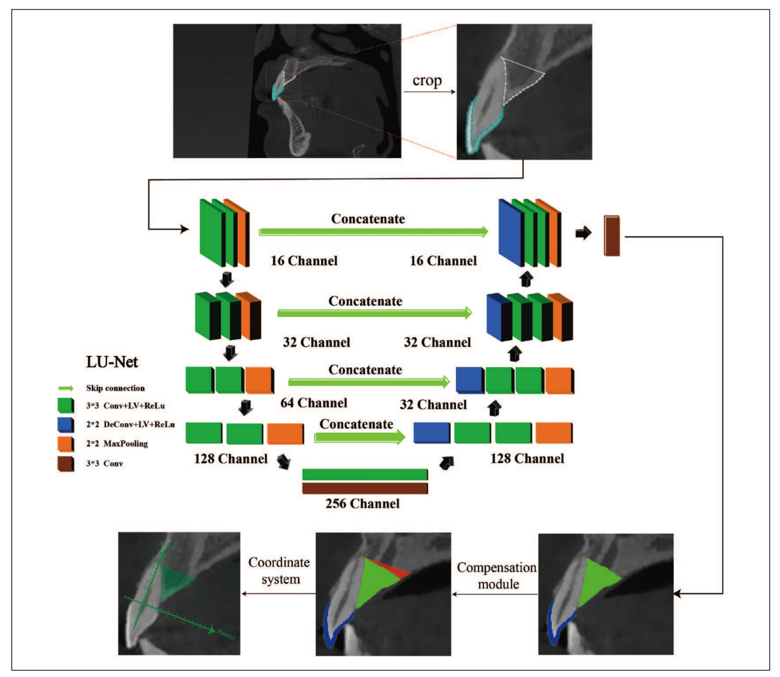 Understanding U-Net: A Comprehensive Guide to Image Segmentation