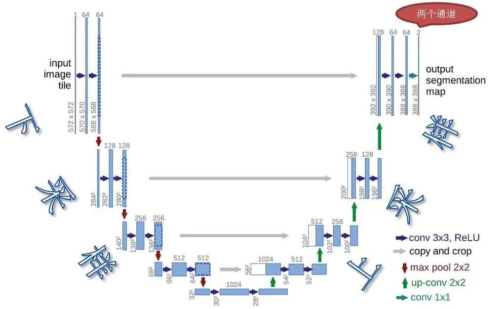 Understanding U-Net: A Comprehensive Guide to Image Segmentation