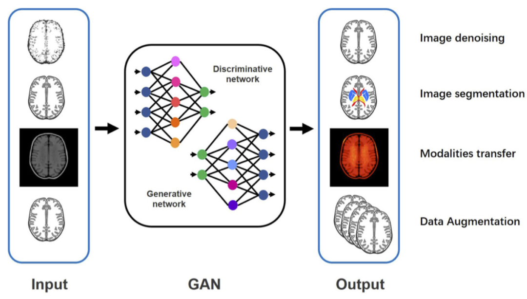 Applications of Generative Adversarial Networks in Alzheimer's Disease Diagnosis and Neuroimaging Data Processing