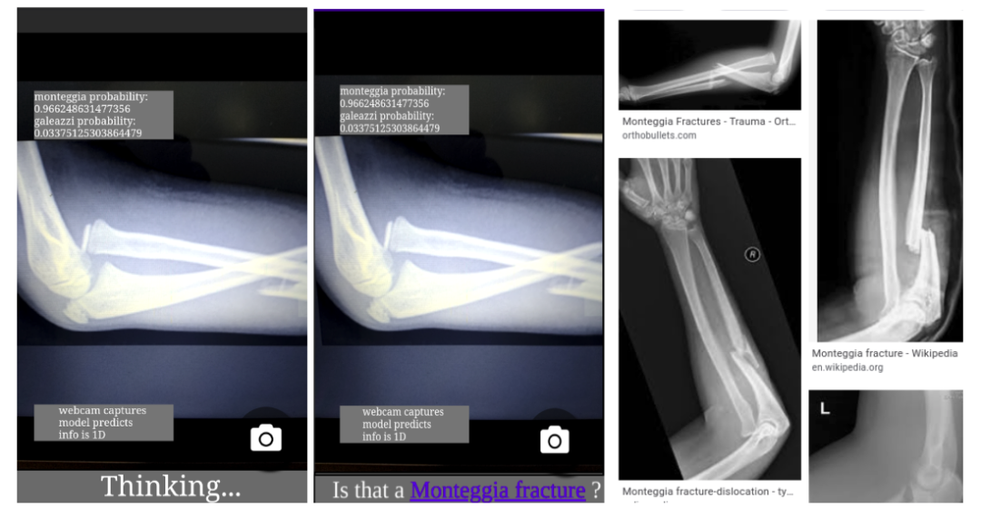 Leveraging TensorFlow.js in Medical Imaging