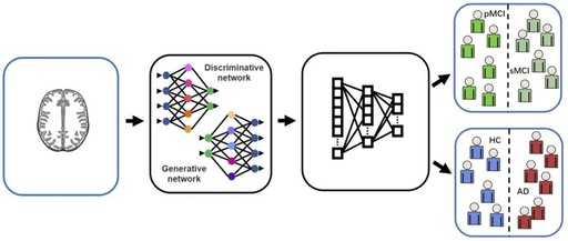 Applications of Generative Adversarial Networks in Alzheimer's Disease Diagnosis and Neuroimaging Data Processing