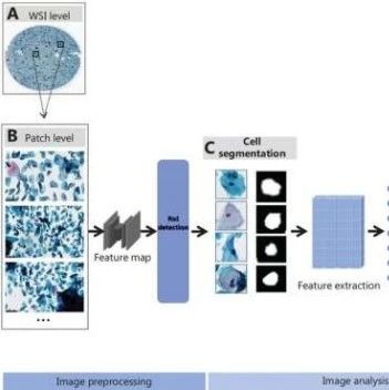 AI Software Enhances Cervical Cancer Detection Through Medical Imaging