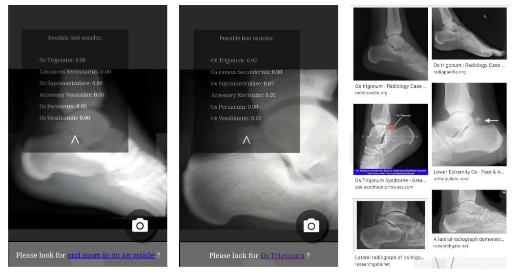 Leveraging TensorFlow.js in Medical Imaging