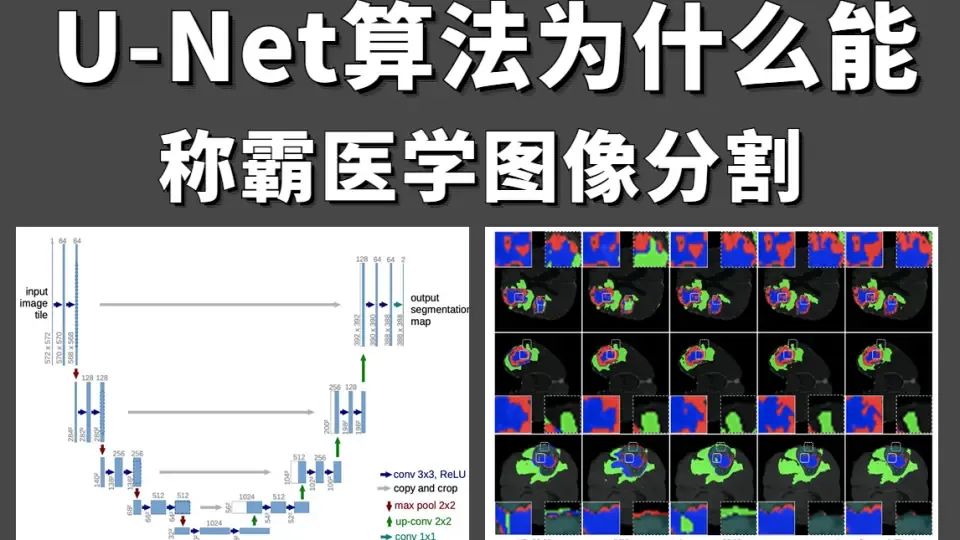 Understanding U-Net: A Comprehensive Guide to Image Segmentation