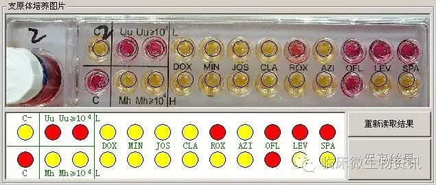 Establishment and Application of Expert System for Clinical Microbiology Laboratory Data Management