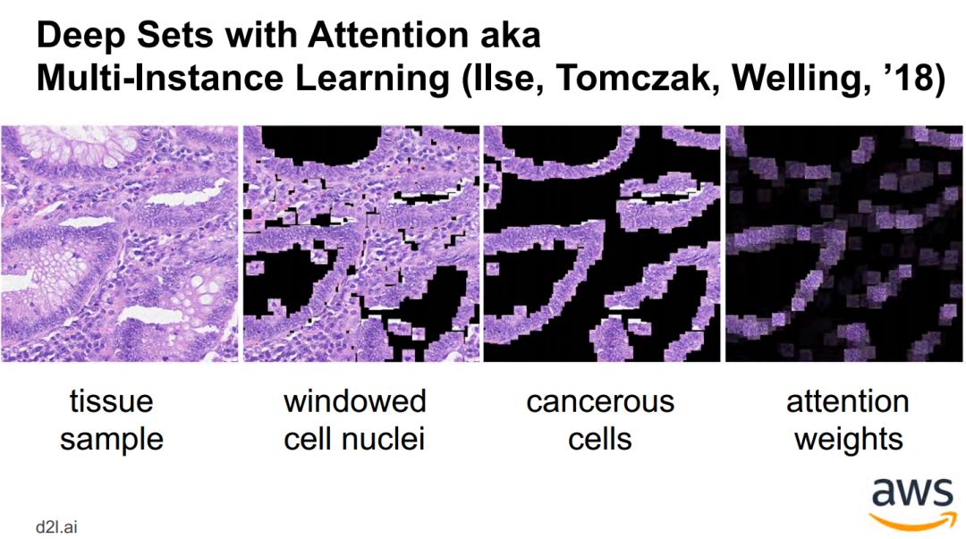 Attention Mechanism in Deep Learning