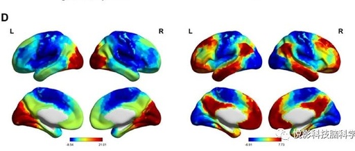 Linking Functional Connectivity Gradients to Individual Creativity