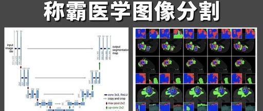 Understanding U-Net: A Comprehensive Guide to Image Segmentation