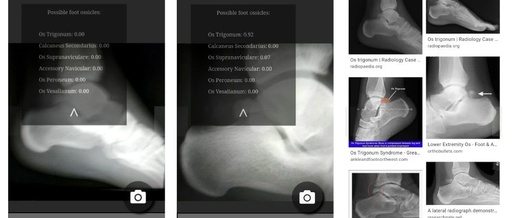 Leveraging TensorFlow.js in Medical Imaging