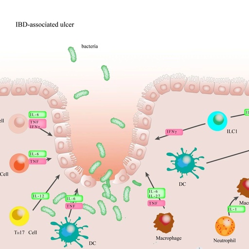 Exploring New Pathways Between Gut Microbiota and Disease: Machine Learning Applications