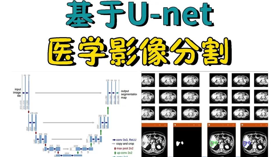 Understanding U-Net: A Comprehensive Guide to Image Segmentation