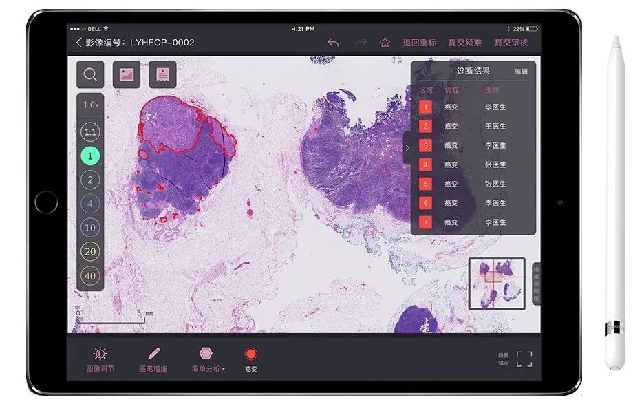 In-Depth Imaging: A Pathology Diagnosis System Based on TensorFlow