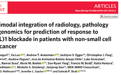 Multimodal Data Integration Enhances Immunotherapy Response Prediction