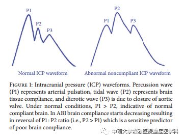 Multimodal Monitoring: A New Tool for Neurocritical Care in Comatose Patients