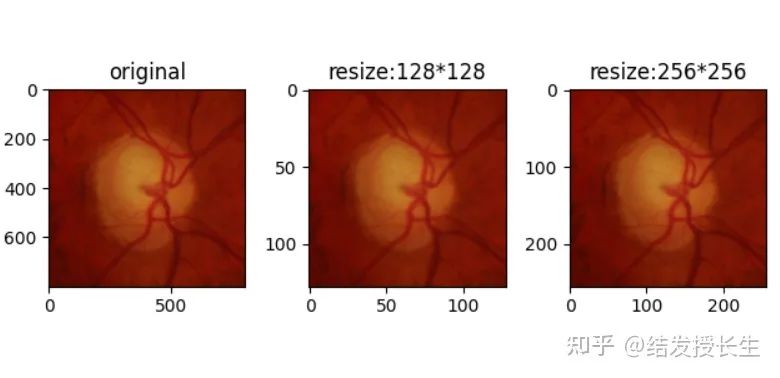 13 Practical Image Augmentation Techniques in Pytorch (With Code)