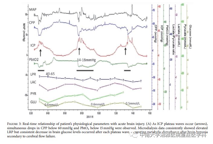 Multimodal Monitoring: A New Tool for Neurocritical Care in Comatose Patients