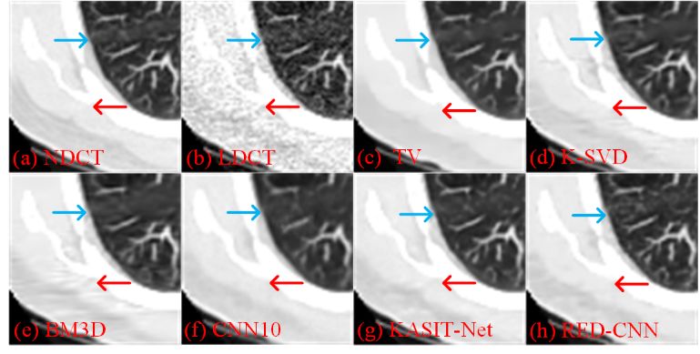 Deep Reconstruction: Image Reconstruction Based on Deep Learning
