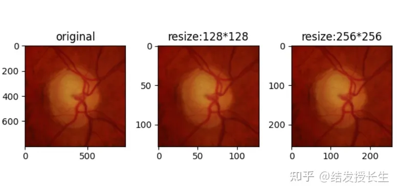 13 Image Augmentation Methods in Pytorch