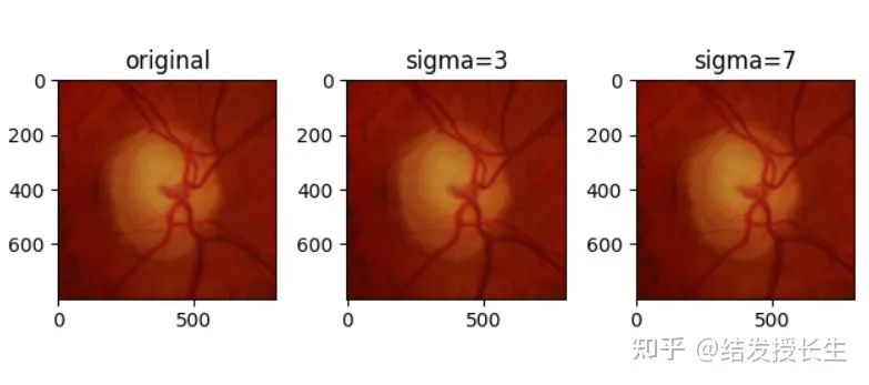 13 Image Augmentation Methods in Pytorch