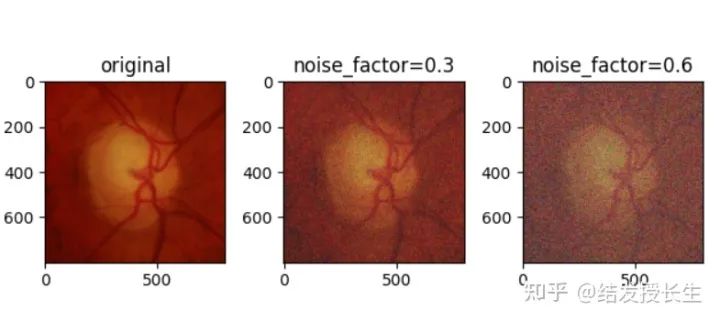 13 Practical Image Augmentation Techniques in Pytorch (With Code)