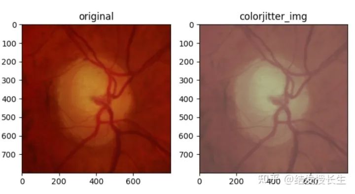 13 Image Augmentation Methods in Pytorch