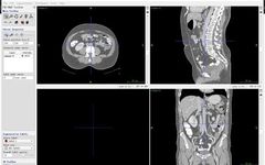 Summary of Medical Image Data Reading and Preprocessing Methods