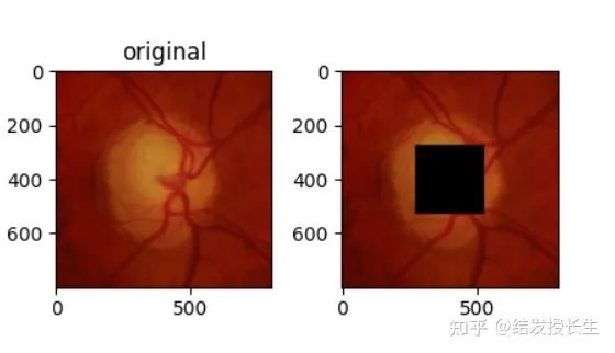 13 Practical Image Augmentation Techniques in Pytorch (With Code)