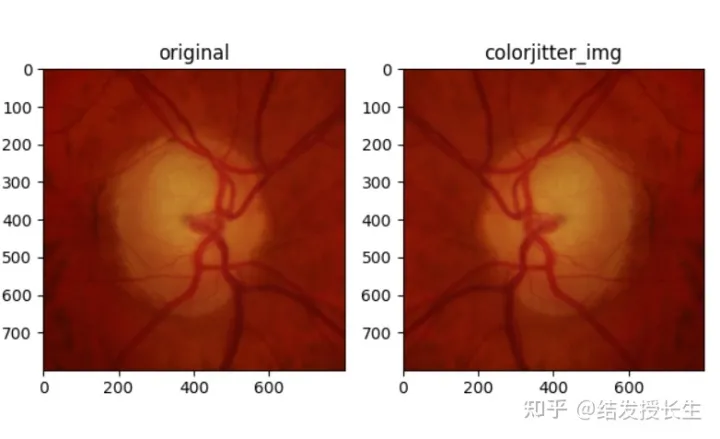 13 Image Augmentation Methods in Pytorch