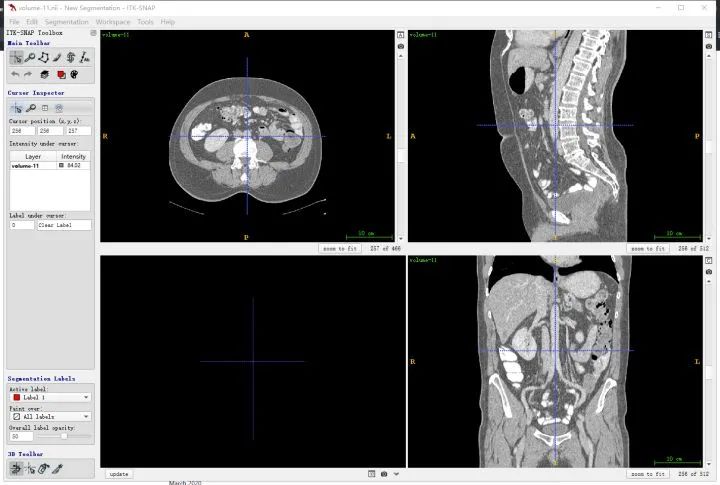 Summary of Medical Image Data Reading and Preprocessing Methods