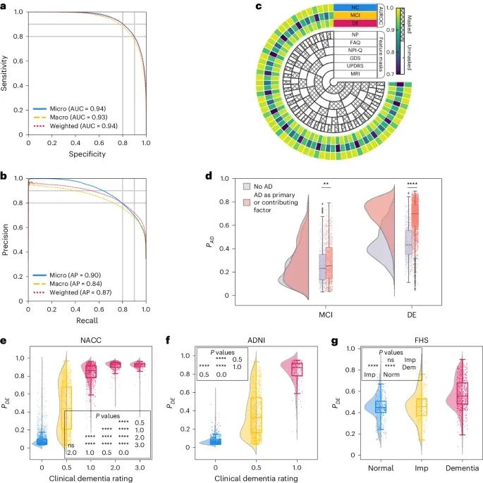 AI-Powered Precision Diagnosis of Dementia