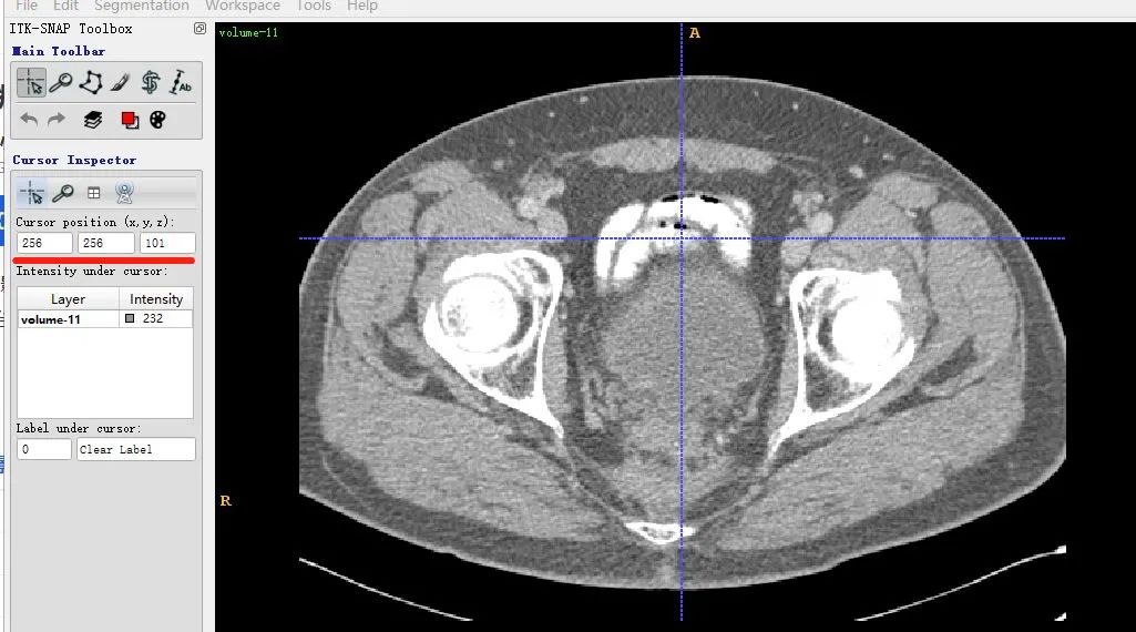 Summary of Medical Image Data Reading and Preprocessing Methods