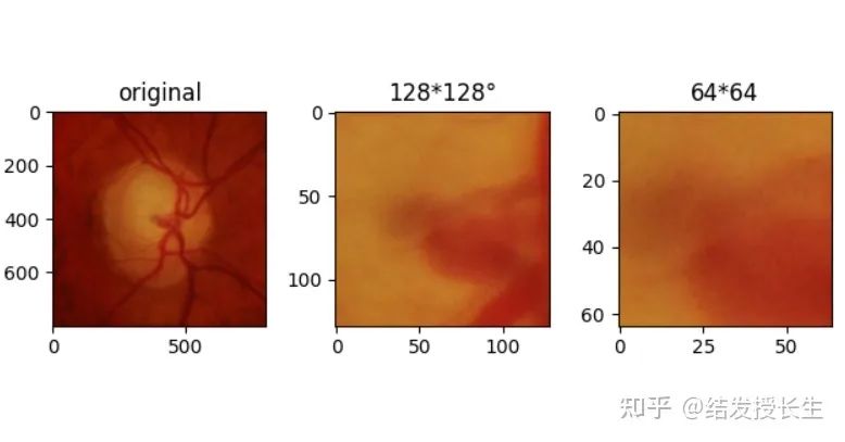 13 Practical Image Augmentation Techniques in Pytorch (With Code)