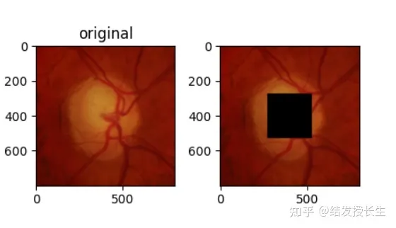 13 Image Augmentation Methods in Pytorch