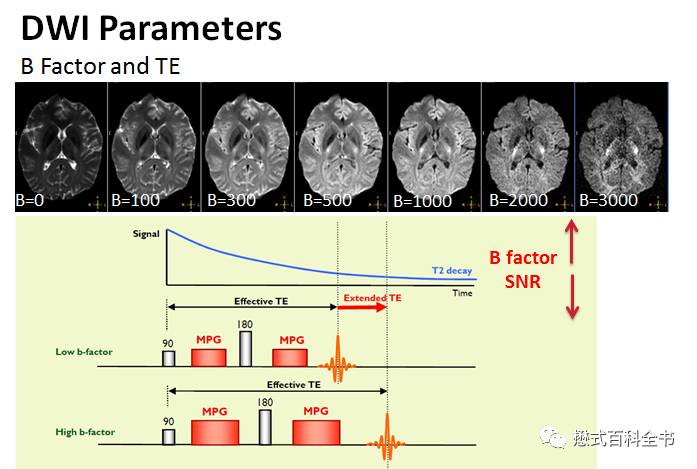 Techniques for Effective Diffusion Weighted Imaging (DWI) and Scanning Parameters