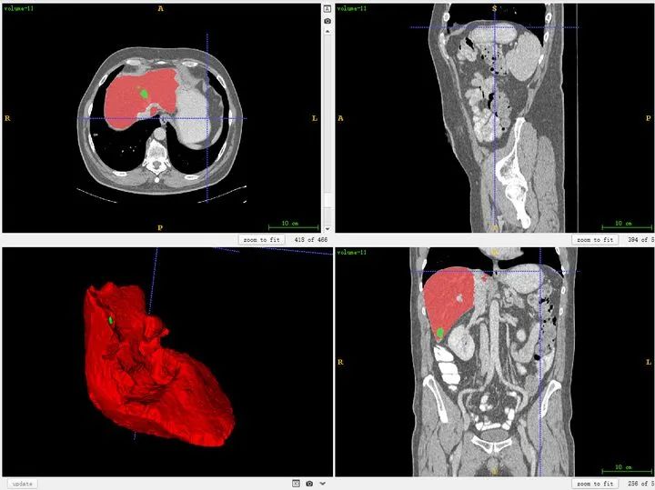 Summary of Medical Image Data Reading and Preprocessing Methods