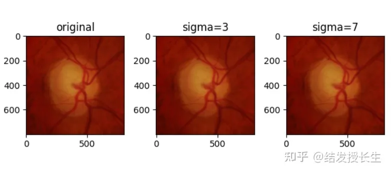 13 Image Augmentation Methods in Pytorch