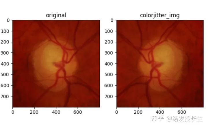 13 Image Augmentation Methods in Pytorch