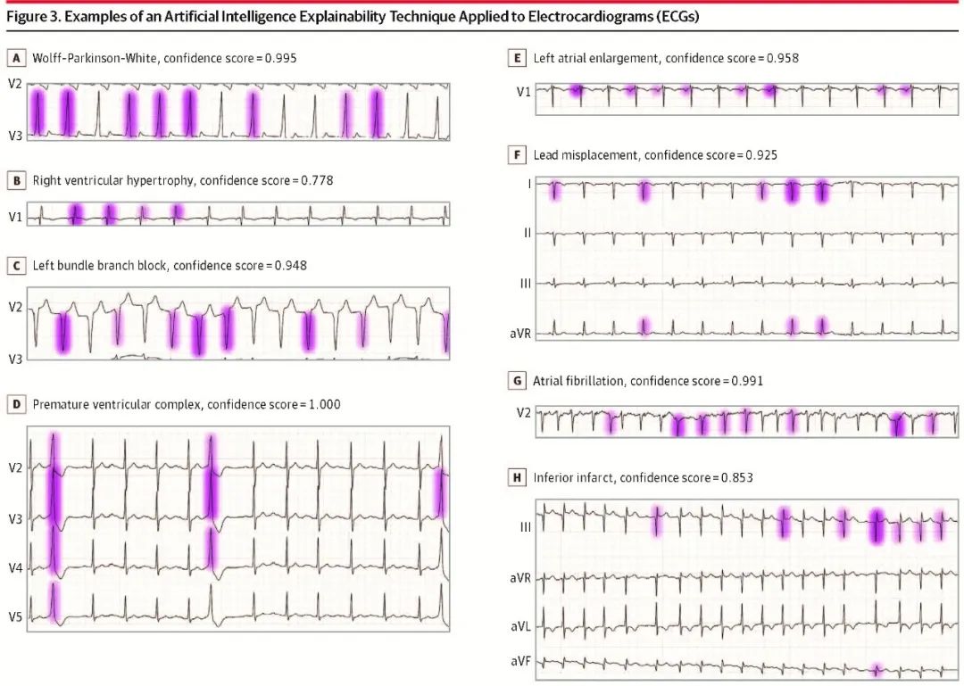 Can Deep Learning Neural Networks Accurately Interpret ECGs?