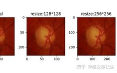13 Practical Image Augmentation Techniques in Pytorch (With Code)