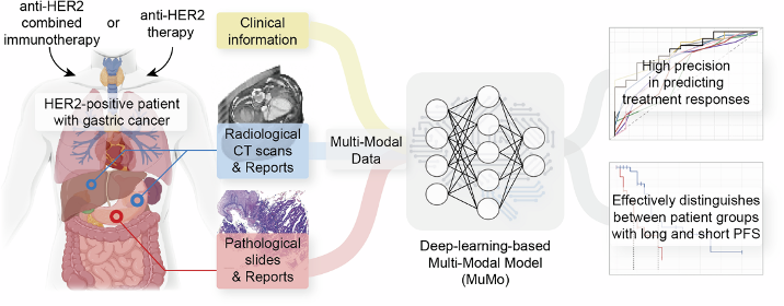 Multi-Modal AI Analysis Technology Aids Precision Prediction of Treatment Response in HER2-Positive Gastric Cancer Patients
