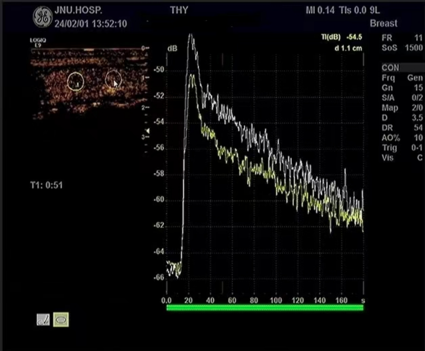 Multimodal Ultrasound Evaluation of Thyroid Nodules