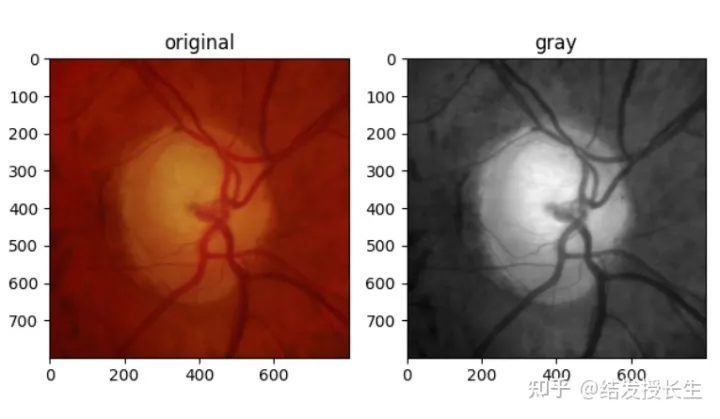 13 Image Augmentation Methods in Pytorch