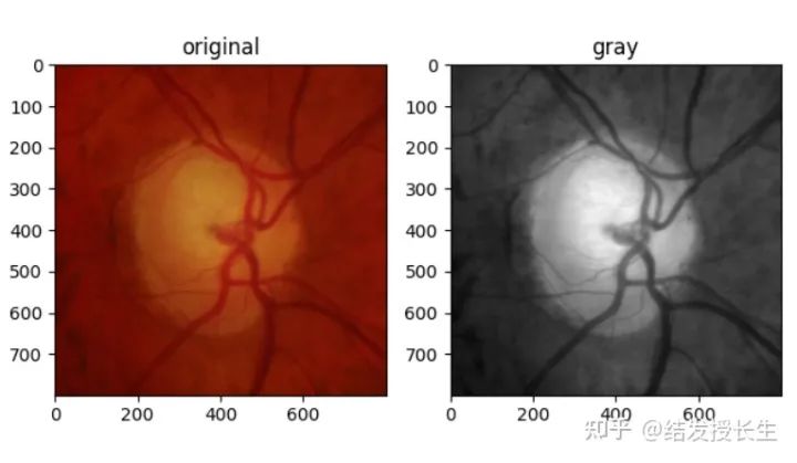 13 Practical Image Augmentation Techniques in Pytorch (With Code)