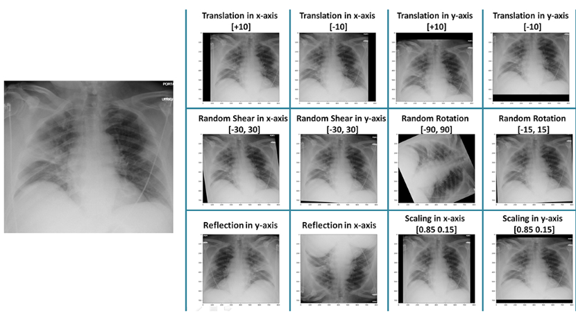 Training Convolutional Neural Networks (CNN) From Scratch Using Data Augmentation