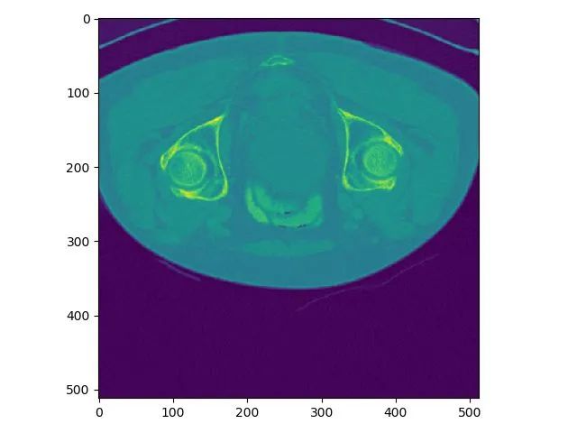 Summary of Medical Image Data Reading and Preprocessing Methods